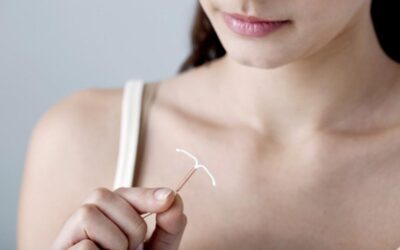 Comparing Contraceptives: Are Implants Better Than the Pill?