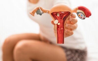 When Are Ovarian Cysts Serious?